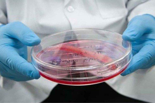 مگاکاریوسیت ها مگاکاریوسیت ها,اخبار پزشکی,خبرهای پزشکی,تازه های پزشکی