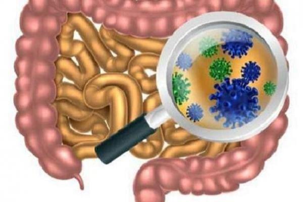 باکتری های روده باکتری های روده,اخبار پزشکی,خبرهای پزشکی,تازه های پزشکی