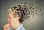 آلزایمر,اخبار پزشکی,خبرهای پزشکی,تازه های پزشکی