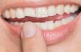 ترمیم دندان‌ها با سلول‌های بنیادی,اخبار پزشکی,خبرهای پزشکی,تازه های پزشکی