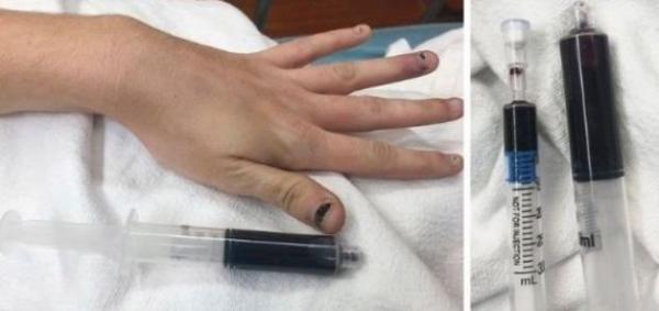 خون آبی رنگ,اخبار جالب,خبرهای جالب,خواندنی ها و دیدنی ها