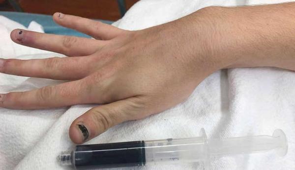 خون آبی رنگ,اخبار جالب,خبرهای جالب,خواندنی ها و دیدنی ها