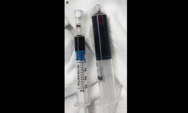 خون آبی رنگ,اخبار جالب,خبرهای جالب,خواندنی ها و دیدنی ها