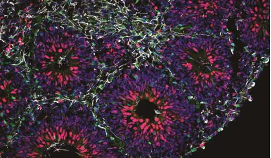 شبیه سازی مغز انسان در ایستگاه فضایی بین المللی شبیه سازی مغز انسان در ایستگاه فضایی بین المللی,اخبار پزشکی,خبرهای پزشکی,تازه های پزشکی