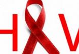 کشف روش جدید برای مقابله با ویروس اچ آی وی ویروس اچ آی وی,اخبار پزشکی,خبرهای پزشکی,تازه های پزشکی