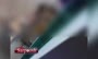 فیلم/ ترفند جدید پزشکان برای فرار از نصب کارتخوان