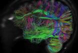کشف مدارهای مغزی مرتبط با اختلال اضطراب,اخبار پزشکی,خبرهای پزشکی,تازه های پزشکی