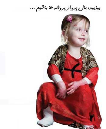 مرگ دختر ایرانی مبتلا به ای‌بی,اخبار سیاسی,خبرهای سیاسی,سیاست خارجی