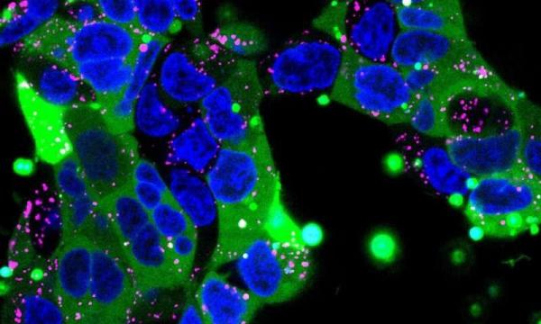 نانومحفظه‌ پلیمری برای انتقال داروهای بیولوژیک به سلول,اخبار پزشکی,خبرهای پزشکی,تازه های پزشکی
