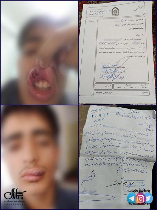 مجروح شدن دانش آموز زنجانی,نهاد های آموزشی,اخبار آموزش و پرورش,خبرهای آموزش و پرورش