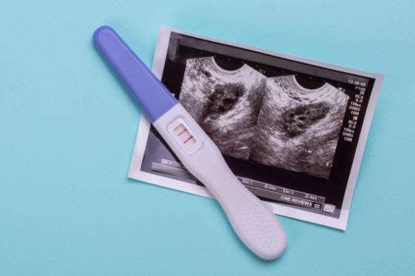 ویژگی های ارثی از پدر و مادر ویژگی های ارثی از پدر و مادر,اخبار پزشکی,خبرهای پزشکی,تازه های پزشکی