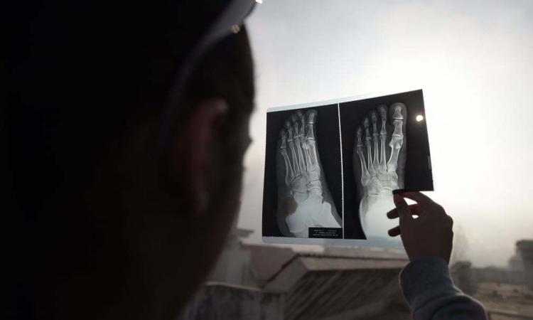 تصاویر خورشیدگرفتگی در ایران تصاویر خورشیدگرفتگی در ایران,عکس های خورشیدگرفتگی در ایران,تصاویر خورشیدگرفتگی حلقوی