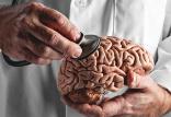 تومورهای مغزی,اخبار پزشکی,خبرهای پزشکی,تازه های پزشکی