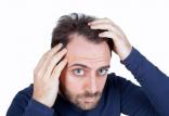 تغییرات مو,اخبار پزشکی,خبرهای پزشکی,تازه های پزشکی