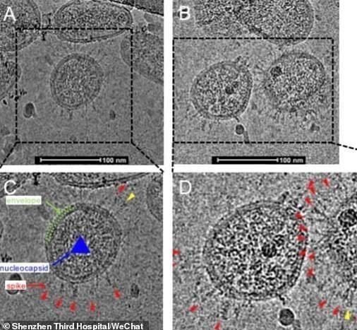 تصویری ازظاهر واقعی کرون تصویری ازظاهر واقعی کرون,اخبار پزشکی,خبرهای پزشکی,بهداشت