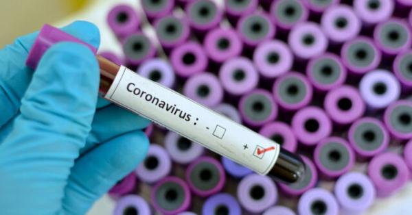 تست‌ کروناویروس در آزمایشگاه های ویژه,اخبار پزشکی,خبرهای پزشکی,بهداشت