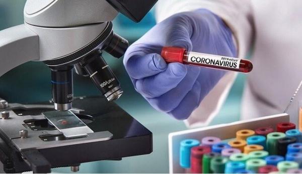 آزمایشات ویروس کرونا,اخبار پزشکی,خبرهای پزشکی,بهداشت