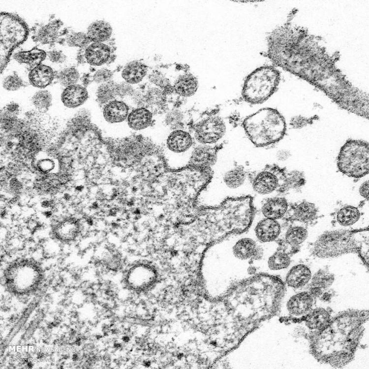 تصاویر ویروس کرونا,عکس های ویروس کرونا با میکروسکوپ,عکس های کرونا ویروس زیر میکروسکوپ