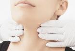 کم‌ کاری تیروئید,اخبار پزشکی,خبرهای پزشکی,مشاوره پزشکی
