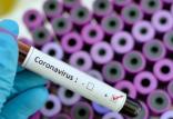 تست کرونا,اخبار پزشکی,خبرهای پزشکی,بهداشت
