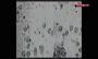 تصاویری از ویروس کرونا زیرِ میکروسکوپ