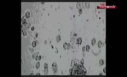 تصاویری از ویروس کرونا زیرِ میکروسکوپ