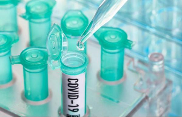 صدور مجوز تست پادتن برای تشخیص کرونا,اخبار پزشکی,خبرهای پزشکی,بهداشت