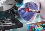ویروس کرونا در اصفهان,اخبار پزشکی,خبرهای پزشکی,بهداشت