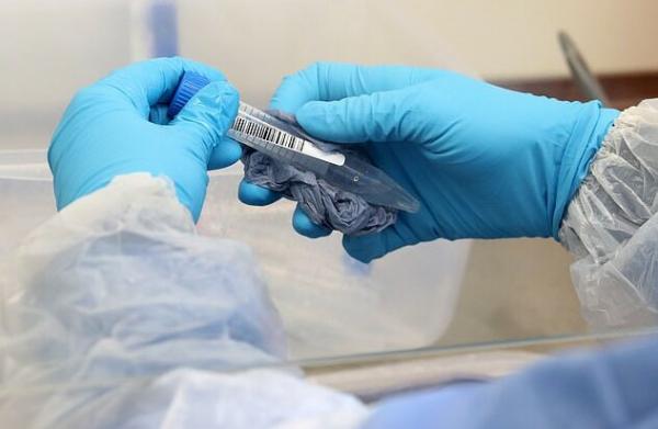 تشخیص ویروس کرونا,اخبار پزشکی,خبرهای پزشکی,تازه های پزشکی