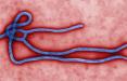 واکسن ویروس ابولا,اخبار پزشکی,خبرهای پزشکی,تازه های پزشکی
