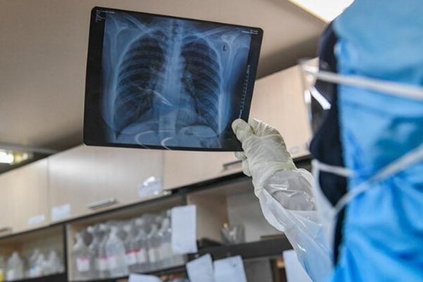 مشکلات تنفسی در بیماران کرونایی,اخبار پزشکی,خبرهای پزشکی,بهداشت
