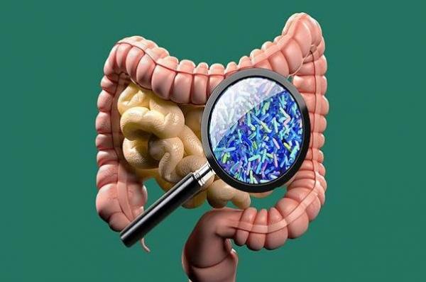 میکروبیوم های روده,اخبار پزشکی,خبرهای پزشکی,تازه های پزشکی