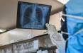 مشکلات تنفسی در بیماران کرونایی,اخبار پزشکی,خبرهای پزشکی,بهداشت