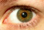 ناخنک چشم,اخبار پزشکی,خبرهای پزشکی,مشاوره پزشکی