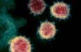سرکوب سلول های ایمنی اصلی بدن توسط ویروس کرونا,اخبار پزشکی,خبرهای پزشکی,تازه های پزشکی