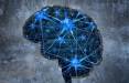 درمان آلزایمر با ارسال امواج الکتریکی عمیق به مغز,اخبار پزشکی,خبرهای پزشکی,تازه های پزشکی