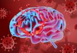 مغز,اخبار پزشکی,خبرهای پزشکی,تازه های پزشکی