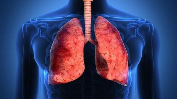 عامل آسیب به ریه در اثر ابتلا به کرونا,اخبار پزشکی,خبرهای پزشکی,تازه های پزشکی