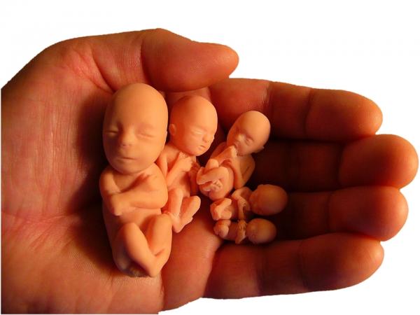 سقط جنین در ماه اول,سقط جنین با دارو,سقط جنین