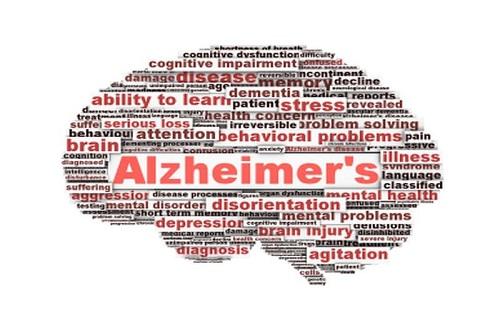 جلوگیری از آلزایمر,علائم بیماری آلزایمر,اختلالات مغزی