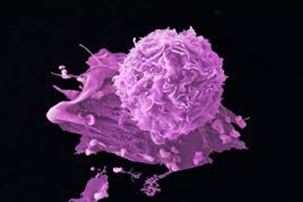 سرطان سینه,تشخیص سرطان سینه,عامل تعیین کننده سرطان سینه