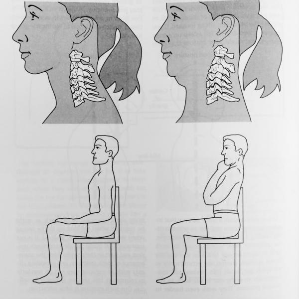 درمان دیسک گردن با ورزش,بالا بردن چانه برای درمان دیسک گردن