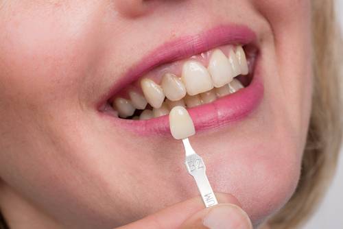 ناحیه ی تاج دندان,ترمیم تاج دندان,افزایش طول تاج دندان