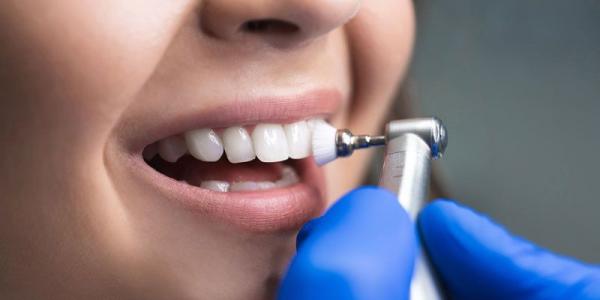 راه های مراقبت از مینای دندان,میناکاری دندان,علت از بین رفتن مینای دندان