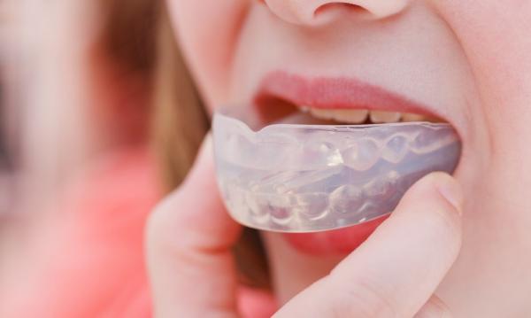 محافظ های دهانی و دندانی,ویژگی‌های یک محافظ دهانی خوب