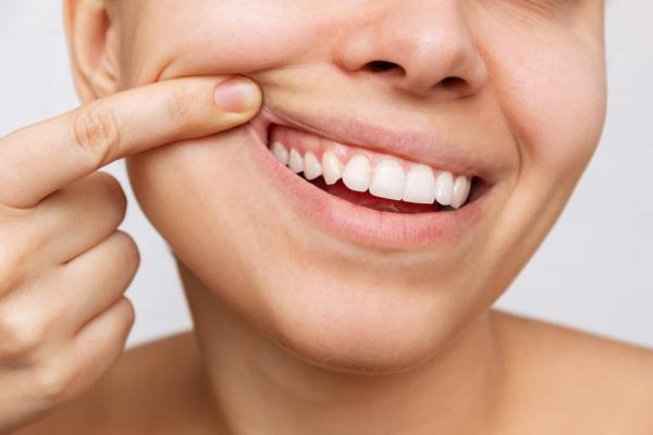 التهاب ناشی از نکروز دندان