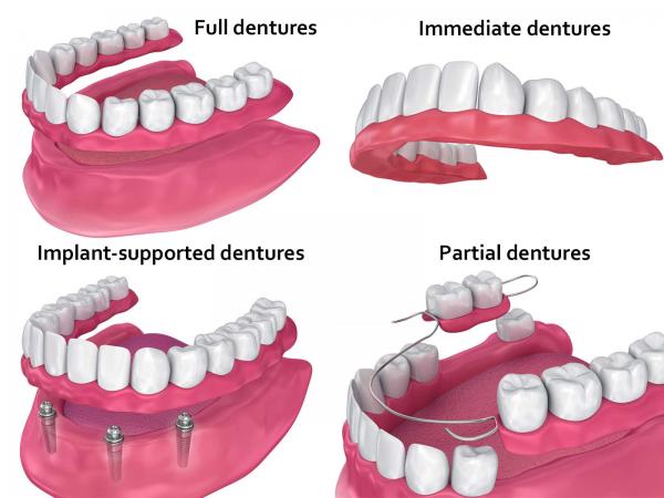 مزایای دندان مصنوعی,دندان مصنوعی,معایب انواع دندان مصنوعی