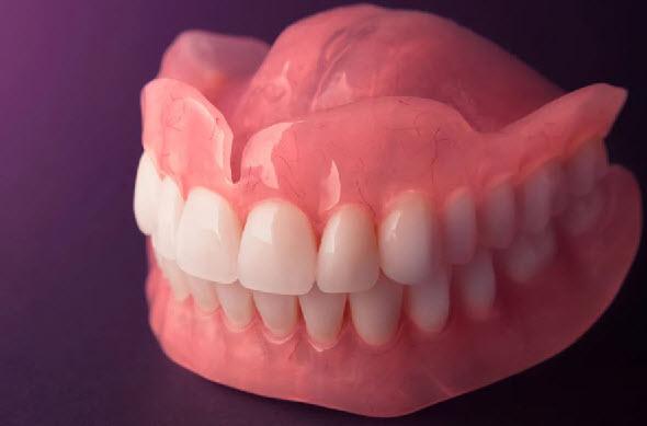 دندان مصنوعی,دندان مصنوعی ثابت,عکس دندان مصنوعی