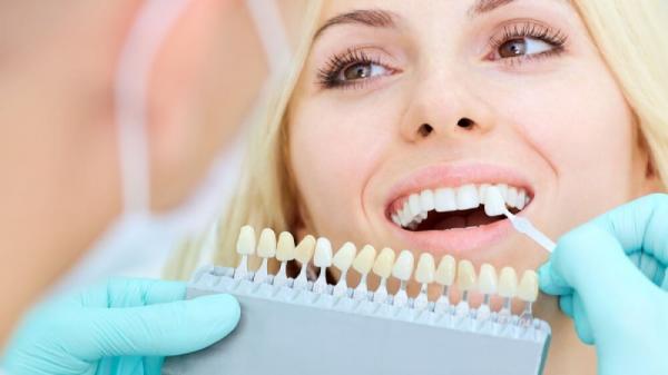 مراقبت صحیح از لمینتها لمینت دندان,مراقبت صحیح از لمینتها