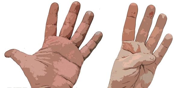 ورزش های مناسب برای آرتروز انگشتان دست,درمان آرتروز انگشتان دست,درمان آرتروز انگشت دست در خانه